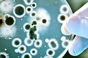 A close up image of a petri dish with a number of bacteria colonies